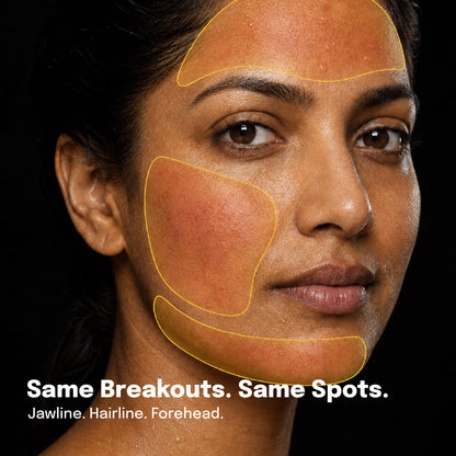 Breakout Breaker Serum